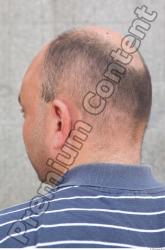 Head Hair Man Casual Slim Average Bald Street photo references